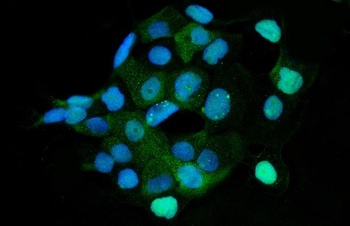 HMGCS1 Rabbit Polyclonal Antibody