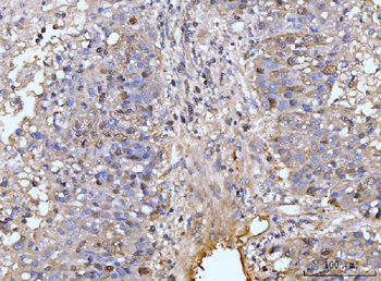 HMGCS1 Rabbit Polyclonal Antibody