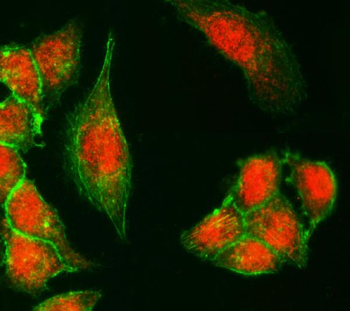 UTX/KDM6A Rabbit Polyclonal Antibody