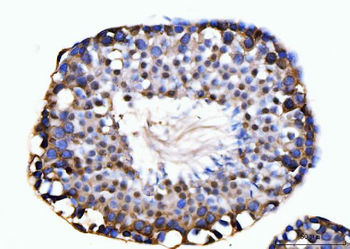 KIFC1 Rabbit Polyclonal Antibody