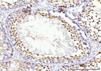 KIFC1 Rabbit Polyclonal Antibody