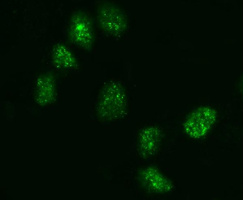 KIFC1 Rabbit Polyclonal Antibody