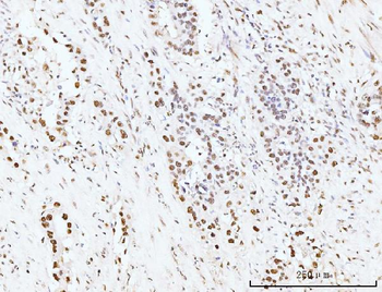 KIFC1 Rabbit Polyclonal Antibody