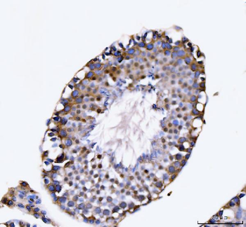 KIFC1 Rabbit Polyclonal Antibody