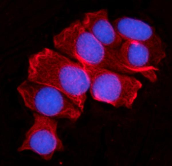 MOV10 Rabbit Polyclonal Antibody