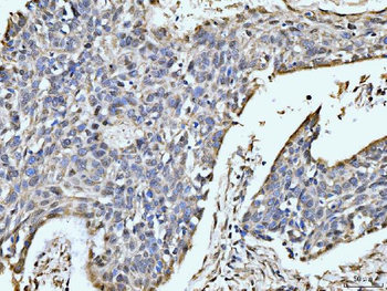 MOV10 Rabbit Polyclonal Antibody