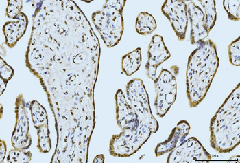 MOV10 Rabbit Polyclonal Antibody