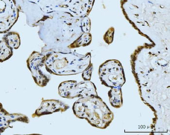 MRE11 Rabbit Polyclonal Antibody