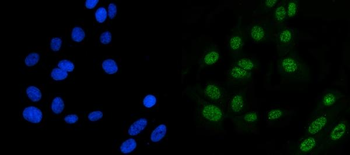 MSH6 Rabbit Polyclonal Antibody