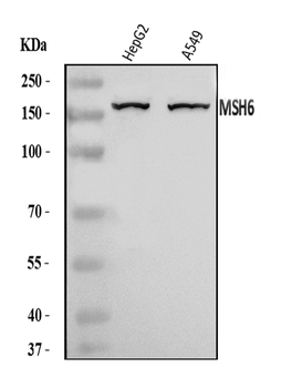 MSH6 Rabbit Polyclonal Antibody