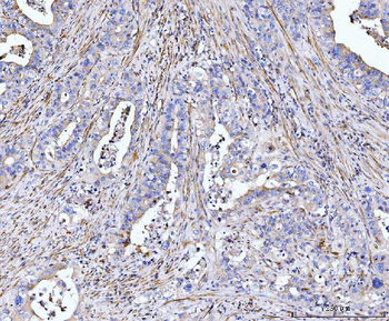 MT-ND5/MT Rabbit Polyclonal Antibody