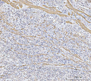 MT-ND5/MT Rabbit Polyclonal Antibody