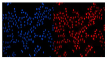 GP210/NUP210 Rabbit Polyclonal Antibody