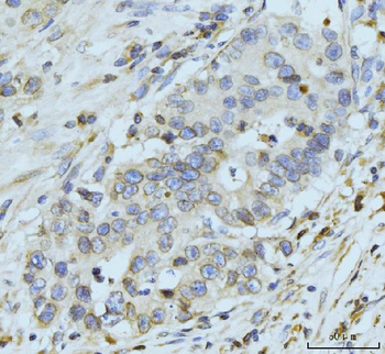 GP210/NUP210 Rabbit Polyclonal Antibody