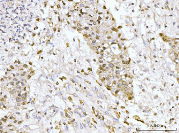 GP210/NUP210 Rabbit Polyclonal Antibody