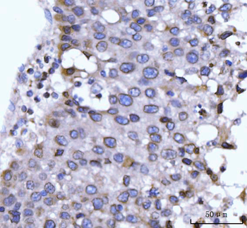 GP210/NUP210 Rabbit Polyclonal Antibody
