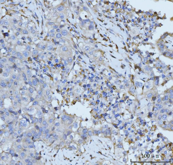 PLD3 Rabbit Polyclonal Antibody