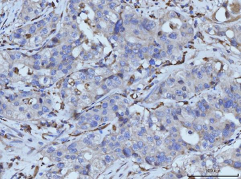 PLD3 Rabbit Polyclonal Antibody