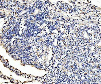 PLD3 Rabbit Polyclonal Antibody