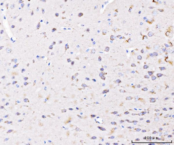 PLD3 Rabbit Polyclonal Antibody