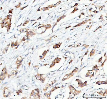 PTGES2/Gbf1 Rabbit Polyclonal Antibody