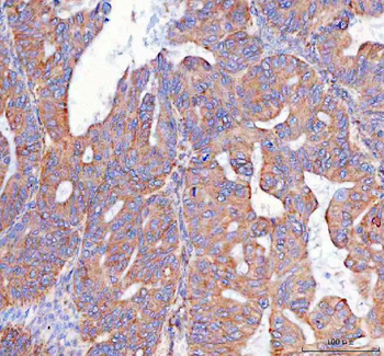 PTGES2/Gbf1 Rabbit Polyclonal Antibody