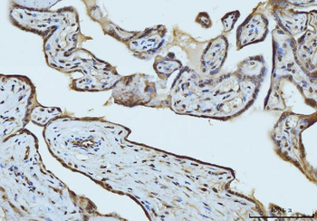 RAE1 Rabbit Polyclonal Antibody