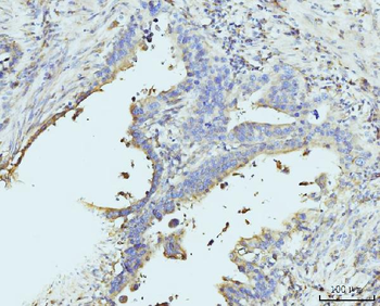 RPL23 Rabbit Polyclonal Antibody