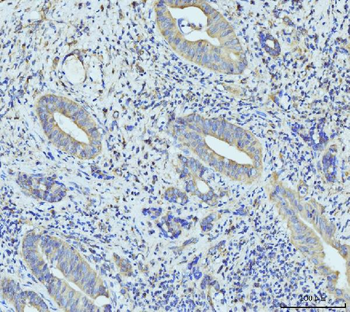 RPL23 Rabbit Polyclonal Antibody