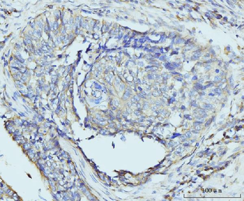 RPL23 Rabbit Polyclonal Antibody