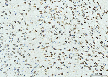 RPL23 Rabbit Polyclonal Antibody