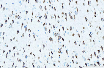 RPL23 Rabbit Polyclonal Antibody