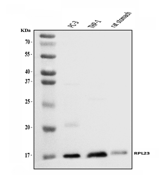 RPL23 Rabbit Polyclonal Antibody
