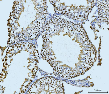 SBNO1 Rabbit Polyclonal Antibody
