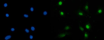 SBNO1 Rabbit Polyclonal Antibody