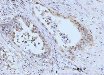 SBNO1 Rabbit Polyclonal Antibody