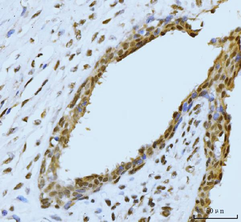 SBNO1 Rabbit Polyclonal Antibody