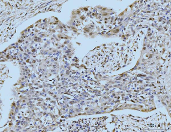 SBNO1 Rabbit Polyclonal Antibody