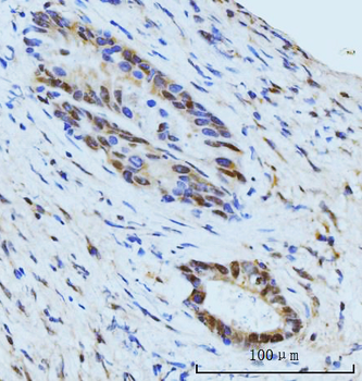 SBNO1 Rabbit Polyclonal Antibody