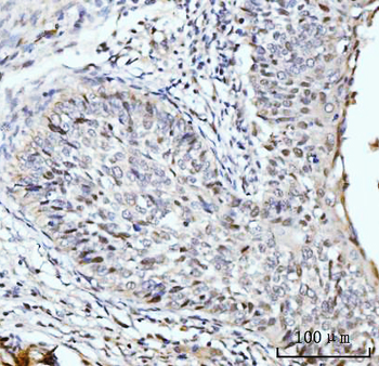 SBNO1 Rabbit Polyclonal Antibody