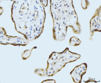 SBNO1 Rabbit Polyclonal Antibody