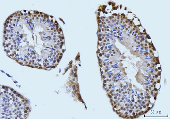 SBNO1 Rabbit Polyclonal Antibody