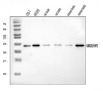 HIP2/LIG/UBE2K Rabbit Polyclonal Antibody