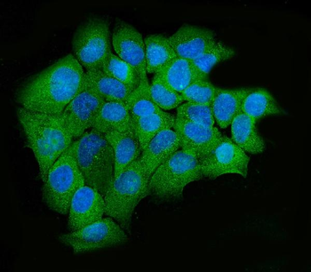 hUPF2/RENT2/UPF2 Rabbit Polyclonal Antibody