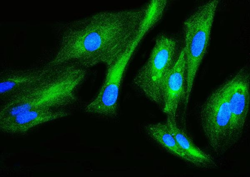 Filamin B/FLNB Rabbit Polyclonal Antibody