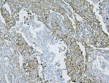 Filamin B/FLNB Rabbit Polyclonal Antibody