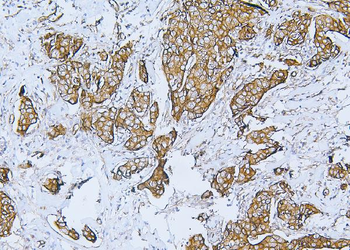 Filamin B/FLNB Rabbit Polyclonal Antibody