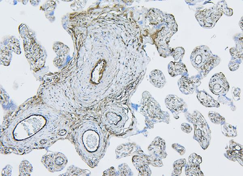 Filamin B/FLNB Rabbit Polyclonal Antibody