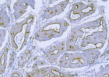 Filamin B/FLNB Rabbit Polyclonal Antibody