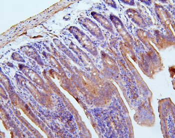 Filamin B/FLNB Rabbit Polyclonal Antibody